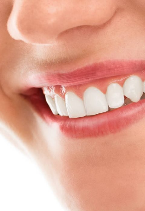 Spruzzino Multi Color Per Frame E Ultra Frame Rotonde E Rettangolari Di - Foto 7